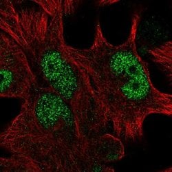 Invitrogen HOXD13 Polyclonal Antibody 100 &mu;L; Unconjugated:Antibodies,