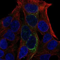 Invitrogen GCKR Polyclonal Antibody 100 &mu;L; Unconjugated:Antibodies,