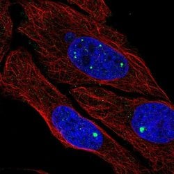 Invitrogen ZDHHC4 Polyclonal Antibody 100 &mu;L; Unconjugated:Antibodies,