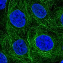 Invitrogen SH2D3A Polyclonal Antibody 100 &mu;L; Unconjugated:Antibodies,