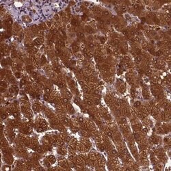 Invitrogen GOT1 Polyclonal Antibody 100 &mu;L | Buy Online | Invitrogen&trade; | Fisher Scientific