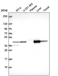 Invitrogen GOT1 Polyclonal Antibody 100 &mu;L | Buy Online | Invitrogen&trade; | Fisher Scientific