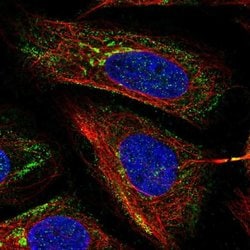 Invitrogen MICB Polyclonal Antibody 100 &mu;L; Unconjugated:Antibodies,