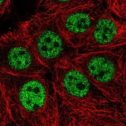 Invitrogen KIAA0196 Polyclonal Antibody 100 &mu;L; Unconjugated:Antibodies,
