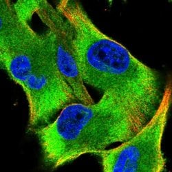 Invitrogen Seryl-tRNA synthetase Polyclonal Antibody 100 &mu;L; Unconjugated:Antibodies,