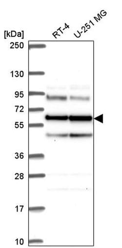 Invitrogen Seryl-tRNA synthetase Polyclonal Antibody 100 &mu;L; Unconjugated:Antibodies,