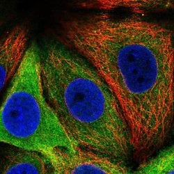 Invitrogen Asparagine Synthetase Polyclonal Antibody 100 &mu;L; Unconjugated:Antibodies,