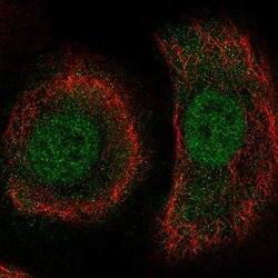Invitrogen TAPP1 Polyclonal Antibody 100 &mu;L; Unconjugated:Antibodies,