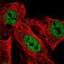 Invitrogen USP42 Polyclonal Antibody 100 &mu;L; Unconjugated:Antibodies,