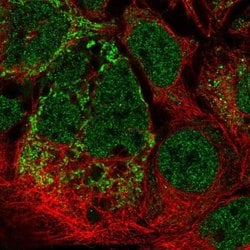 Invitrogen MRPL2 Polyclonal Antibody 100 &mu;L; Unconjugated:Antibodies,