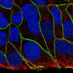 Invitrogen KIAA1522 Polyclonal Antibody 100 &mu;L; Unconjugated:Antibodies,