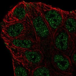 Invitrogen ABCA6 Polyclonal Antibody 100 &mu;L; Unconjugated:Antibodies,