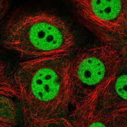 Invitrogen CSTF1 Polyclonal Antibody 100 &mu;L; Unconjugated:Antibodies,