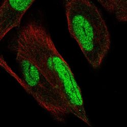 Invitrogen PKNOX1 Polyclonal Antibody 100 &mu;L; Unconjugated:Antibodies,