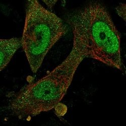 Invitrogen FBXO32 Polyclonal Antibody 100 &mu;L; Unconjugated:Antibodies,