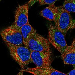 Invitrogen ZDHHC21 Polyclonal Antibody 100 &mu;L; Unconjugated:Antibodies,