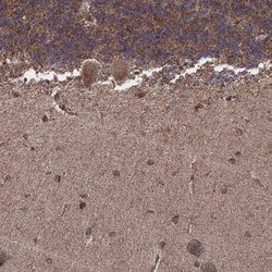 Invitrogen ZDHHC21 Polyclonal Antibody 100 &mu;L; Unconjugated:Antibodies,