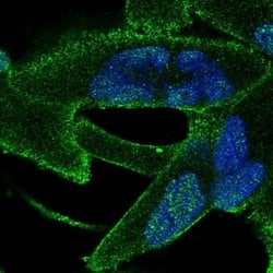 Invitrogen ANKRA2 Polyclonal Antibody 100 &mu;L; Unconjugated:Antibodies,