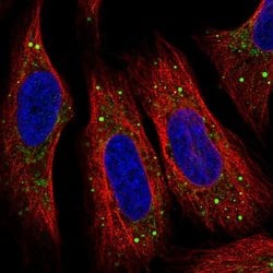 Invitrogen SMIM5 Polyclonal Antibody 100 &mu;L; Unconjugated:Antibodies,