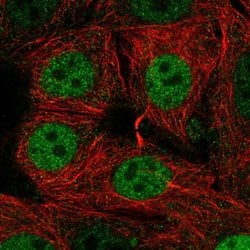 Invitrogen SIVA1 Polyclonal Antibody 100 &mu;L; Unconjugated:Antibodies,