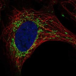 Invitrogen SLC9B1 Polyclonal Antibody 100 &mu;L; Unconjugated:Antibodies,