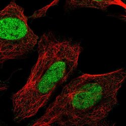 Invitrogen CHTF8 Polyclonal Antibody 100 &mu;L; Unconjugated:Antibodies,