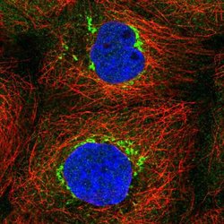 Invitrogen TVP23C Polyclonal Antibody 100 &mu;L; Unconjugated:Antibodies,