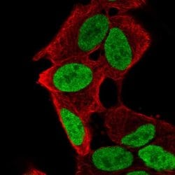 Invitrogen PHOX2A Polyclonal Antibody 100 &mu;L; Unconjugated:Antibodies,