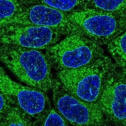 Invitrogen ORMDL1 Polyclonal Antibody 100 &mu;L; Unconjugated:Antibodies,