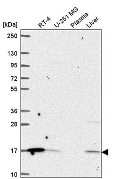 Invitrogen ORMDL1 Polyclonal Antibody 100 &mu;L; Unconjugated:Antibodies,
