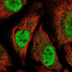 Invitrogen TTC39C Polyclonal Antibody 100 &mu;L; Unconjugated:Antibodies,