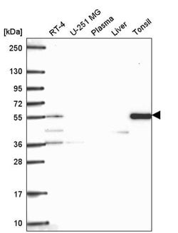 Invitrogen TTC39C Polyclonal Antibody 100 &mu;L; Unconjugated:Antibodies,