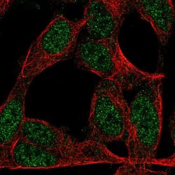 Invitrogen ZNF423 Polyclonal Antibody 100 &mu;L; Unconjugated:Antibodies,
