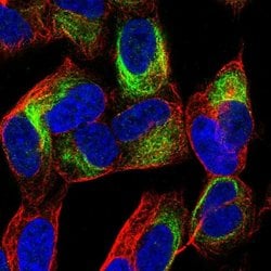 Invitrogen TBC1D16 Polyclonal Antibody 100 &mu;L; Unconjugated:Antibodies,
