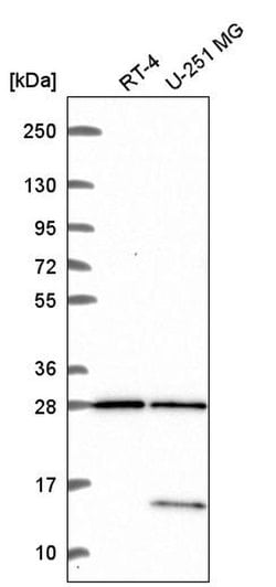Invitrogen TBC1D16 Polyclonal Antibody 100 &mu;L; Unconjugated:Antibodies,