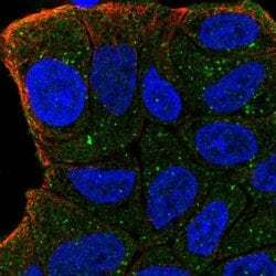 Invitrogen ZFYVE9 Polyclonal Antibody 100 &mu;L; Unconjugated:Antibodies,
