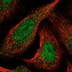 Invitrogen CDKL1 Polyclonal Antibody 100 &mu;L; Unconjugated:Antibodies,