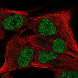 Invitrogen SCML4 Polyclonal Antibody 100 μL; Unconjugated:Antibodies,