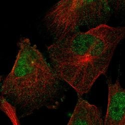 Invitrogen SEMA4F Polyclonal Antibody 100 &mu;L; Unconjugated:Antibodies,
