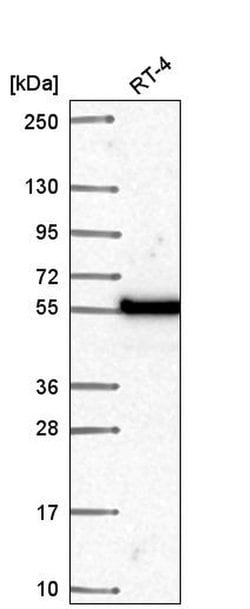 Invitrogen POLM Polyclonal Antibody 100 &mu;L; Unconjugated:Antibodies,
