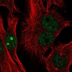 Invitrogen&trade;&nbsp;CTC-534A2.2 Polyclonal Antibody