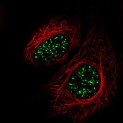 Invitrogen&trade;&nbsp;SRRM2 Polyclonal Antibody