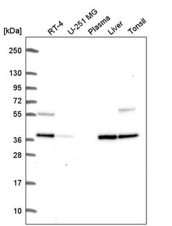 Invitrogen C9orf64 Polyclonal Antibody 100 &mu;L | Buy Online | Invitrogen&trade; | Fisher Scientific