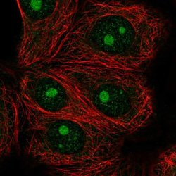 Invitrogen IMP4 Polyclonal Antibody 100 &mu;L; Unconjugated:Antikroppar