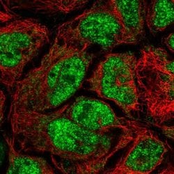 Invitrogen CDK5RAP1 Polyclonal Antibody 100 &mu;L; Unconjugated:Antibodies,