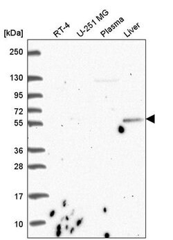 Invitrogen CDK5RAP1 Polyclonal Antibody 100 &mu;L; Unconjugated:Antibodies,