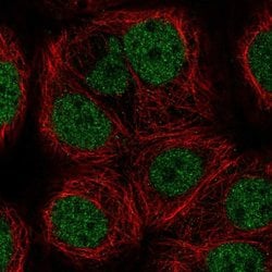 Invitrogen MYST1 Polyclonal Antibody 100 &mu;L; Unconjugated:Anticuerpos
