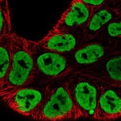 Invitrogen hnRNP A3 Polyclonal Antibody 100 &mu;L; Unconjugated:Antibodies,
