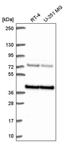 Invitrogen hnRNP A3 Polyclonal Antibody 100 &mu;L; Unconjugated:Antibodies,