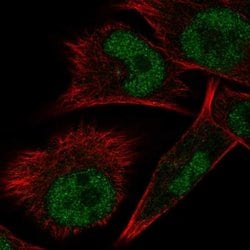 Invitrogen ELAC1 Polyclonal Antibody 100 &mu;L; Unconjugated:Antibodies,